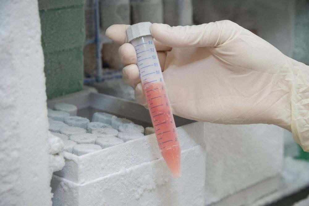 Archivo - Muestras de biopsia líquida Archivo