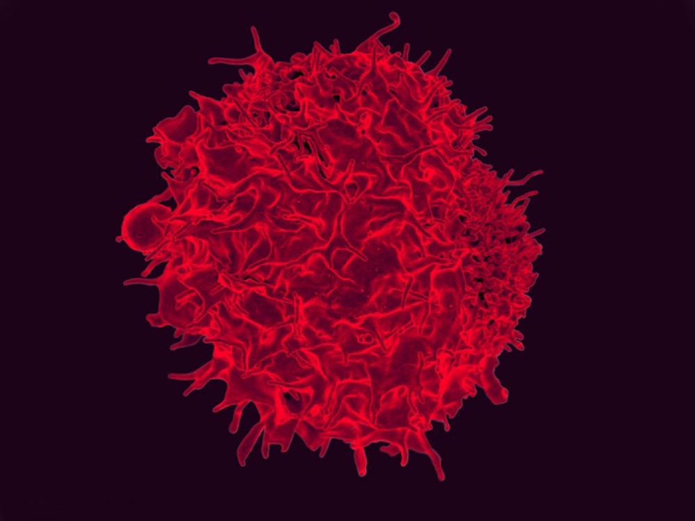 Micrografía