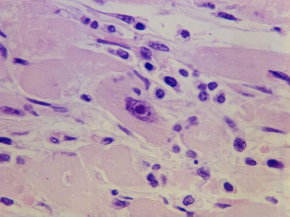 Tejido y células del músculo cardíaco Tejido