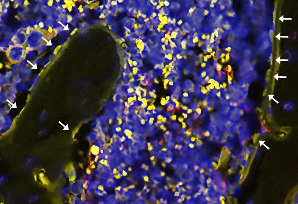 El tratamiento con minociclina redujo la expresión de proteínas en los osteoblastos (células cuboidales amarillas de revestimiento óseo indicadas con flechas). El