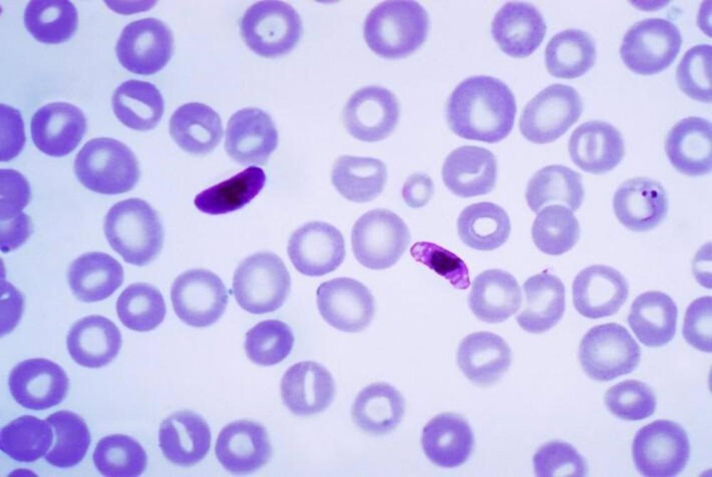 Archivio - Plasmodium falciparum, un parassita che causa la malaria cerebrale. Archivio