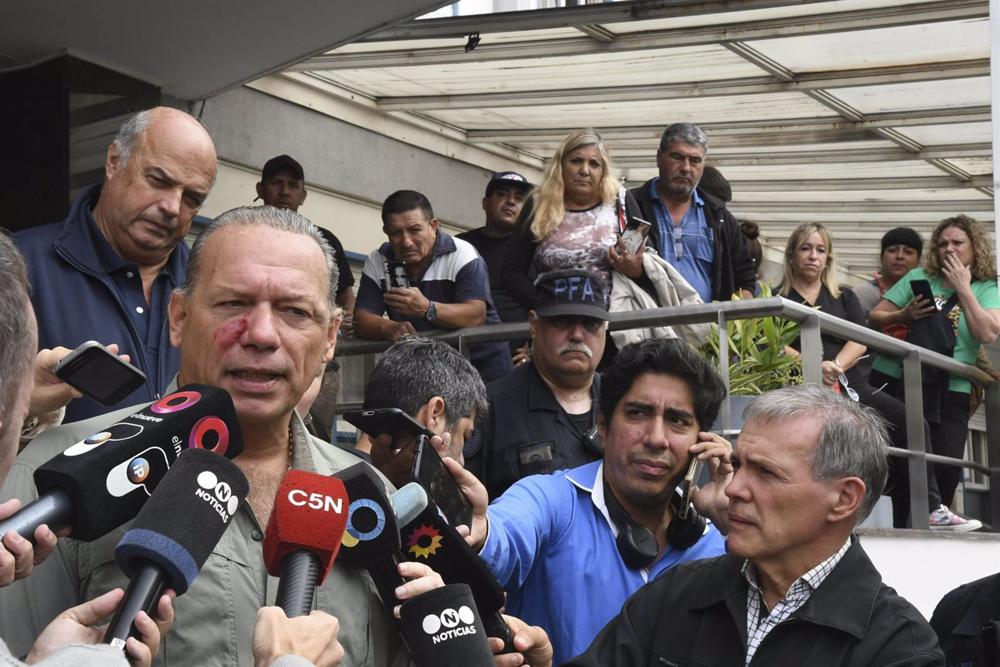 El ministro de Seguridad de la provincia argentina de Buenos Aires, Sergio Berni, tras ser agredido El