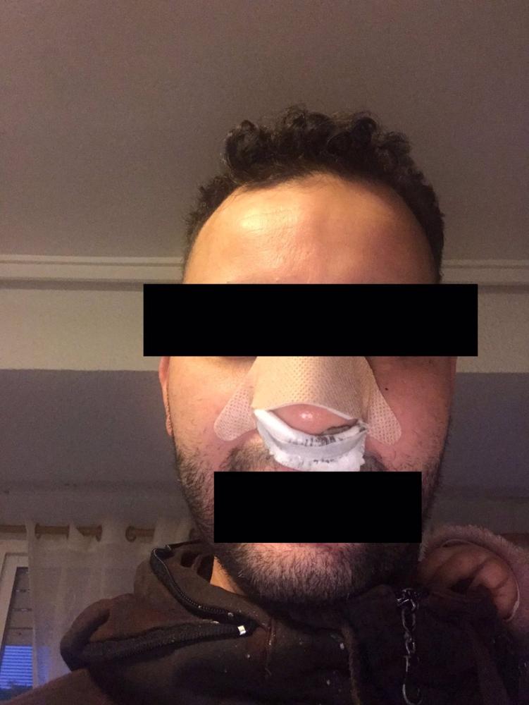 Archivo - Un juez investiga a seis personas por la presunta agresión racista de vigilantes de una discoteca a un joven en Valencia Archivo